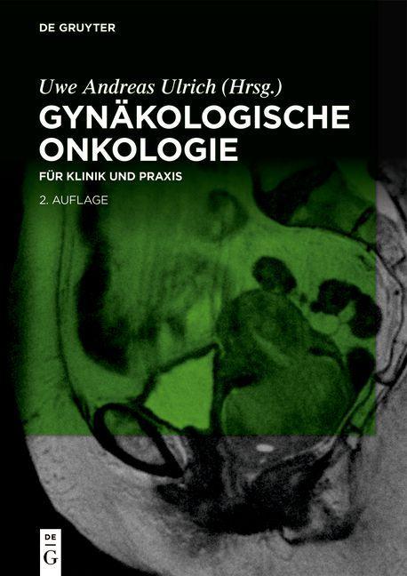 Kniha Gynakologische Onkologie 