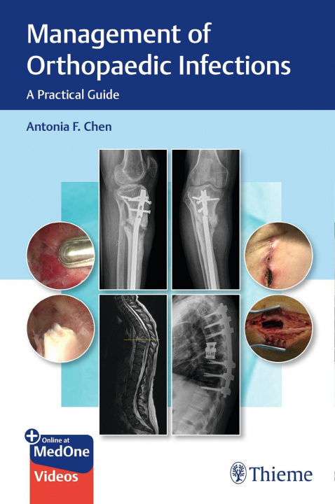 Book Management of Orthopaedic Infections 