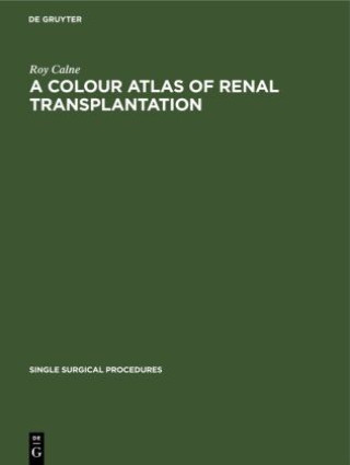 Kniha Colour Atlas of Renal Transplantation 