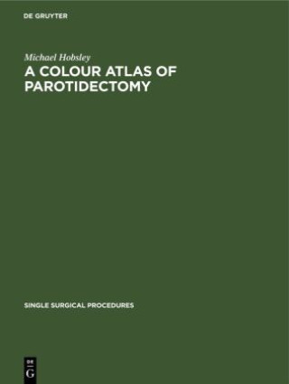 Carte Colour Atlas of Parotidectomy 