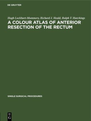 Könyv Colour Atlas of Anterior Resection of the Rectum Richard J. Heald