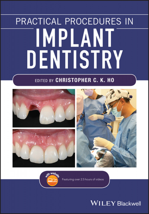 Könyv Practical Procedures in Implant Dentistry CHRISTOPHER C. K HO