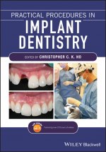 Kniha Practical Procedures in Implant Dentistry CHRISTOPHER C. K HO