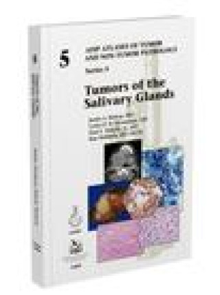 Carte Tumors of the Salivary Glands Justin A. Bishop