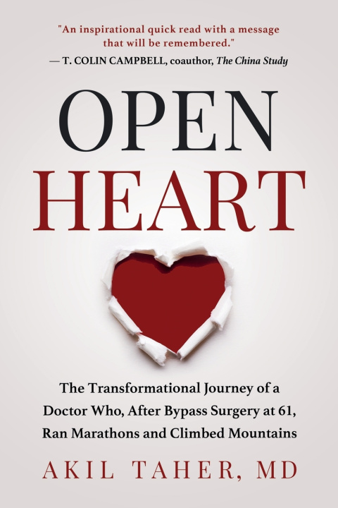 Knjiga Open Heart TAHER MD AKIL TAHER