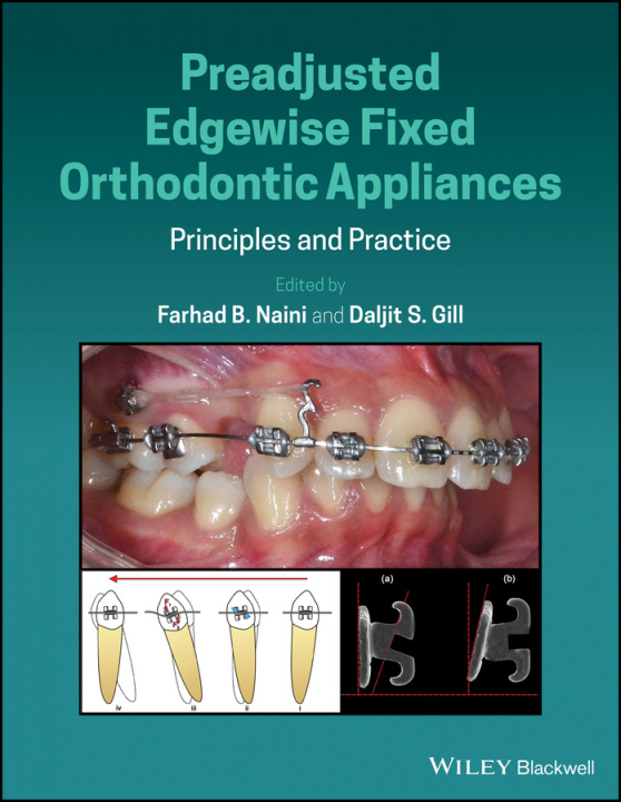 Kniha Preadjusted Edgewise Fixed Orthodontic Appliances - Principles and Practice Farhad B. Naini
