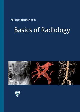 Carte Basics of Radiology Miroslav Heřman