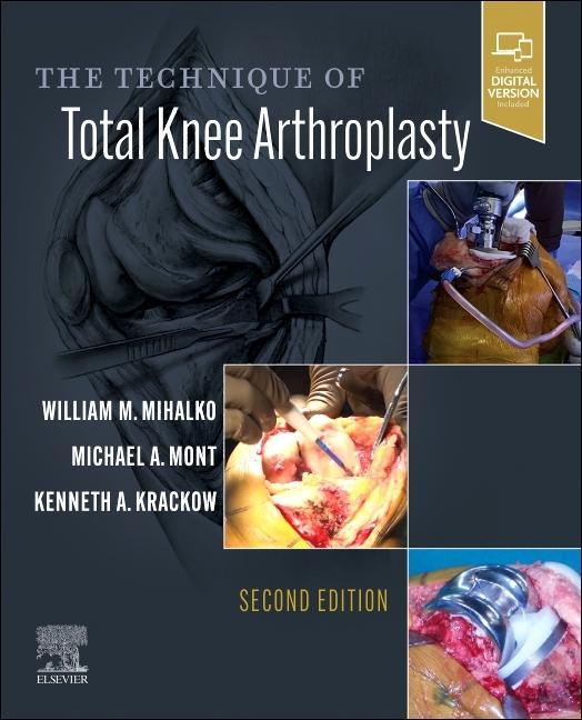 Kniha Technique of Total Knee Arthroplasty William M. Mihalko