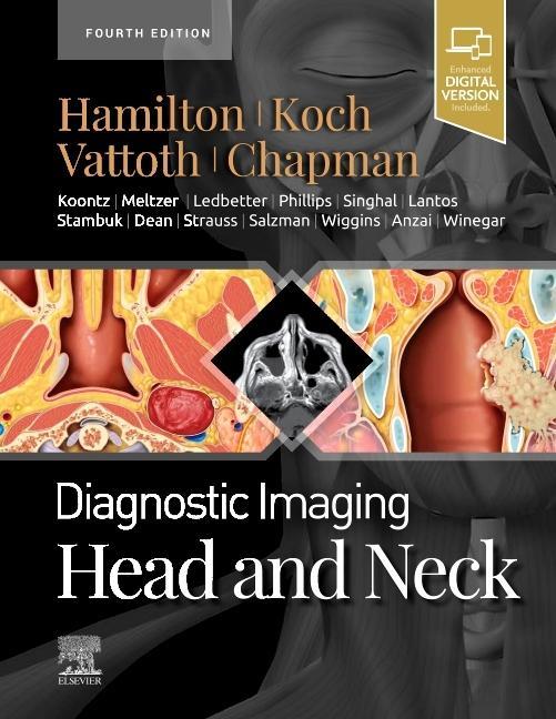Kniha Diagnostic Imaging: Head and Neck Bernadette L. Koch