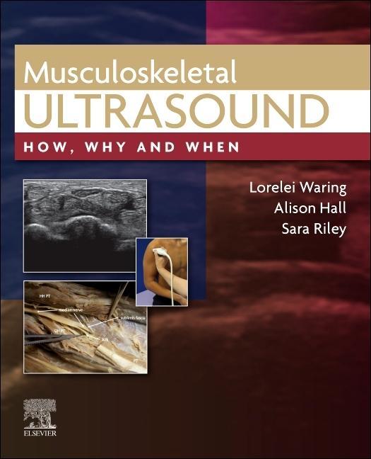 Книга Musculoskeletal Ultrasound LORELEI WARING
