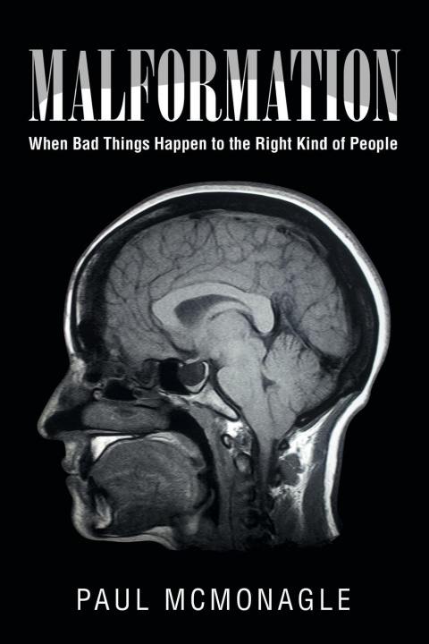 Buch Malformation McMonagle Paul McMonagle
