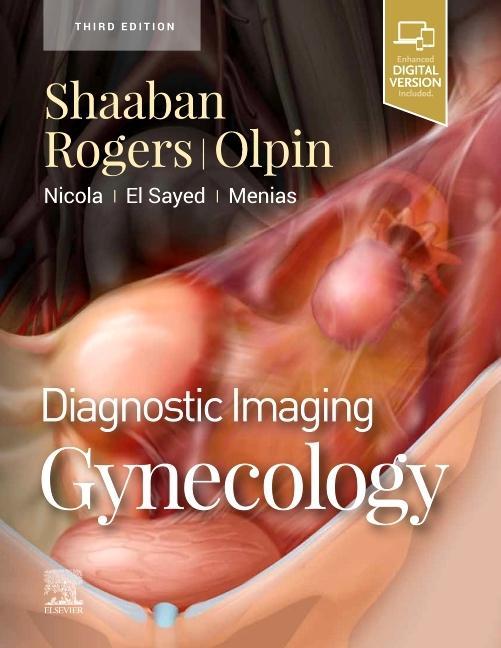 Книга Diagnostic Imaging: Gynecology Akram M Shaaban
