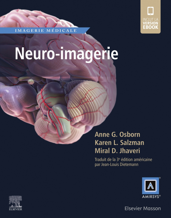 Kniha Neuro-imagerie Anne G. Osborn