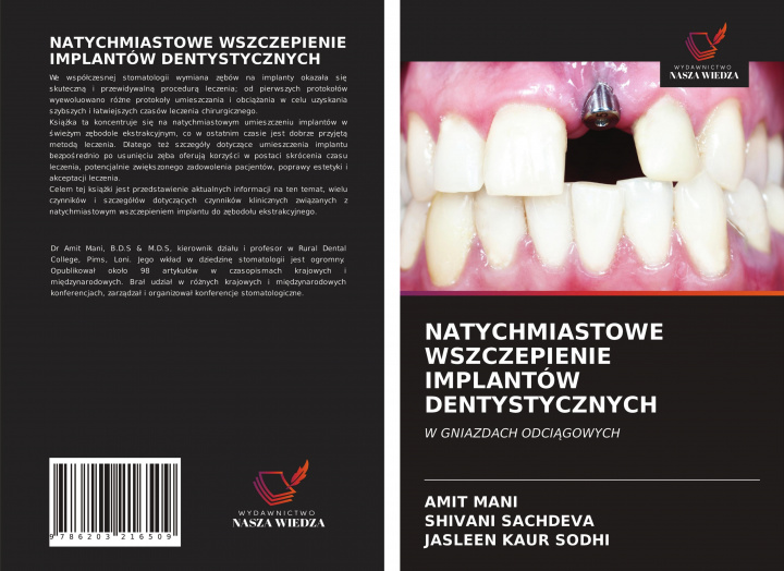 Knjiga Natychmiastowe Wszczepienie Implantow Dentystycznych MANI AMIT MANI