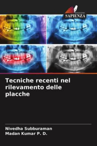Knjiga Tecniche recenti nel rilevamento delle placche Subburaman Nivedha Subburaman
