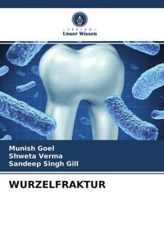 Knjiga Wurzelfraktur Goel Munish Goel