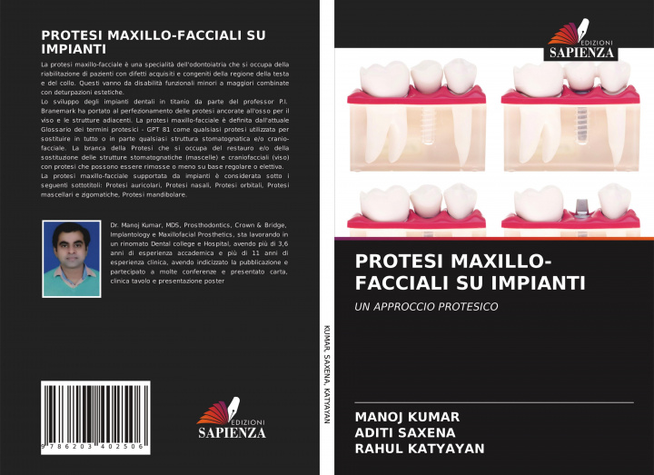Kniha Protesi Maxillo-Facciali Su Impianti Kumar Manoj Kumar