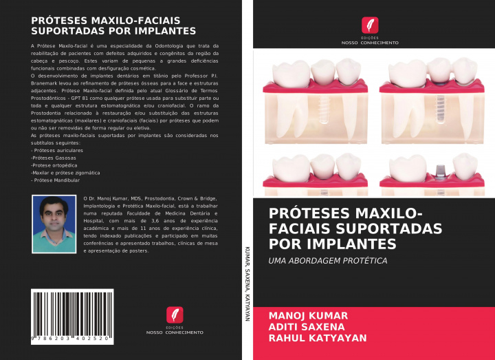 Kniha Proteses Maxilo-Faciais Suportadas Por Implantes Kumar Manoj Kumar