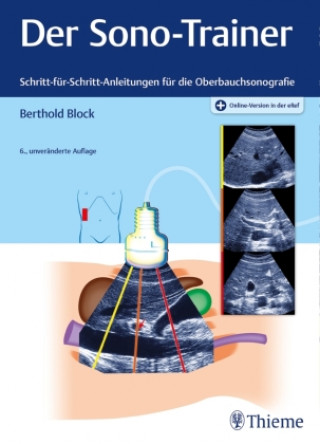 Kniha Der Sono-Trainer Berthold Block
