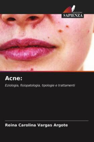 Książka Acne Reina Carolina Vargas Argote