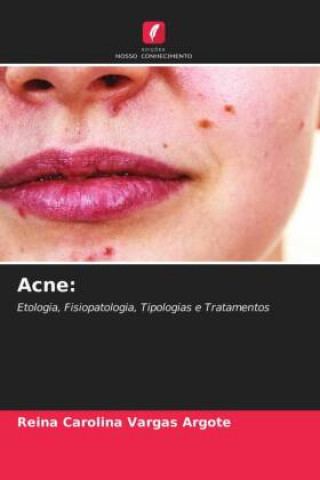 Knjiga Acne Reina Carolina Vargas Argote