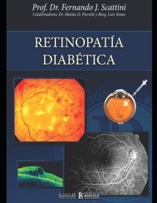 Book Retinopatia diabetica Luis Simes