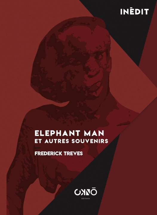 Book Elephant Man TREVES