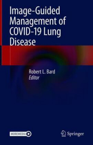 Carte Image-Guided Management of COVID-19 Lung Disease 