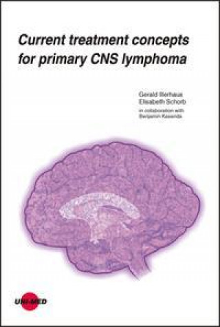 Kniha Current treatment concepts for primary CNS lymphoma Elisabeth Schorb