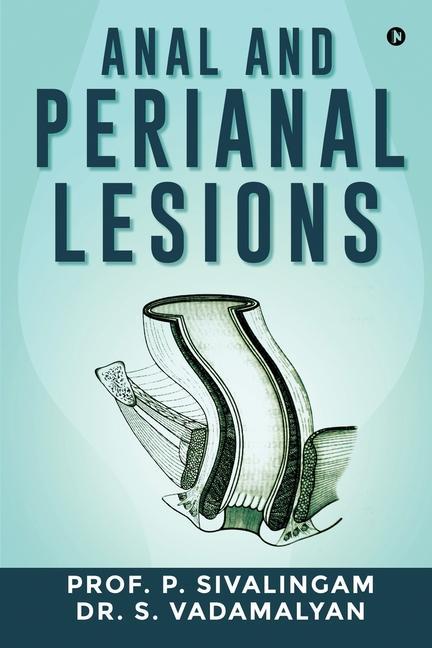 Книга Anal and Perianal Lesions P Sivalingam