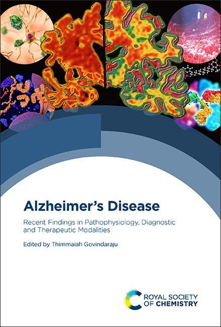Könyv Alzheimer's Disease 