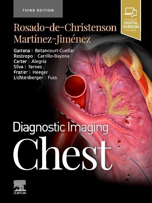 Könyv Diagnostic Imaging: Chest Melissa L. Rosado-de-Christenson