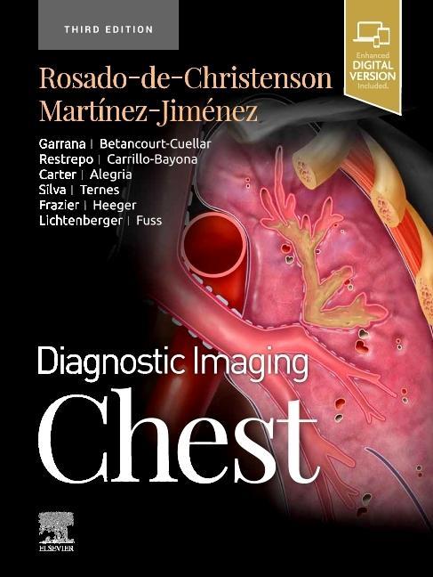 Książka Diagnostic Imaging: Chest Melissa L. Rosado-de-Christenson