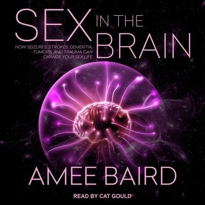 Audio Sex in the Brain: How Seizures, Strokes, Dementia, Tumors, and Trauma Can Change Your Sex Life Cat Gould