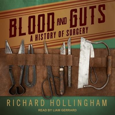 Audio Blood and Guts: A History of Surgery Liam Gerrard