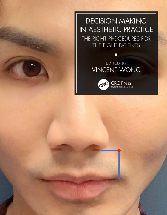 Kniha Decision Making in Aesthetic Practice Vincent Wong