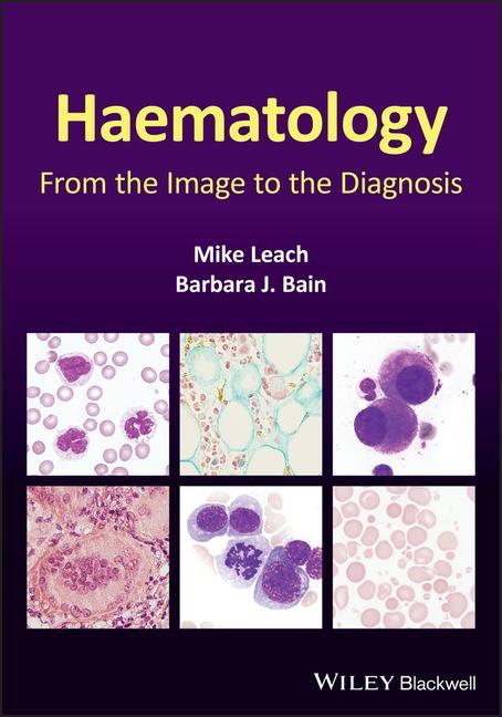 Könyv Haematology - From the Image to the Diagnosis Mike Leach