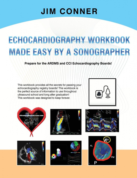 Könyv Echocardiography Workbook JIM CONNER