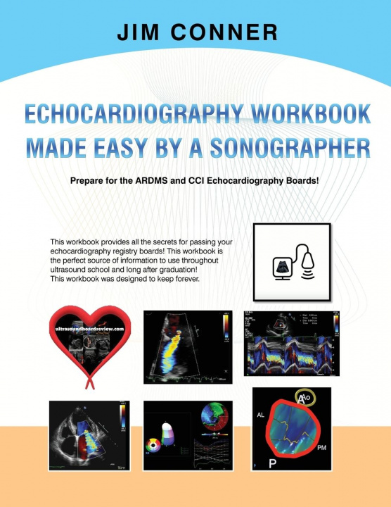 Buch Echocardiography Workbook JIM CONNER