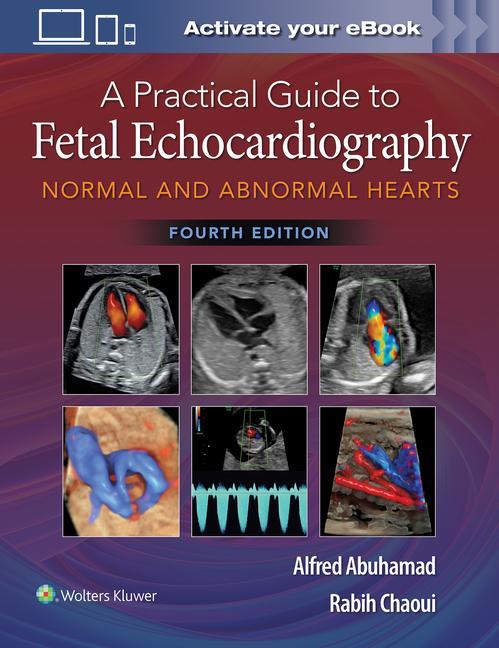 Kniha Practical Guide to Fetal Echocardiography Alfred Z. Abuhamad