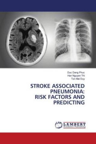 Könyv Stroke Associated Pneumonia DUC DANG PHUC