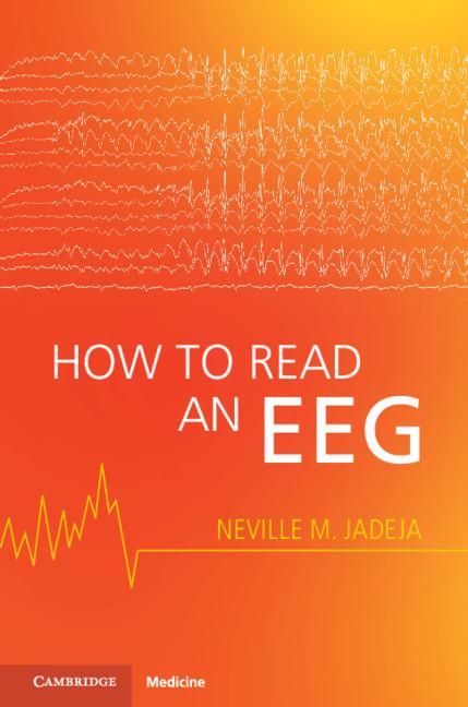 Книга How to Read an EEG 