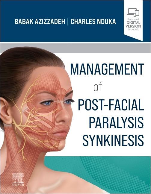 Könyv Management of Post-Facial Paralysis Synkinesis Babak Azizzadeh