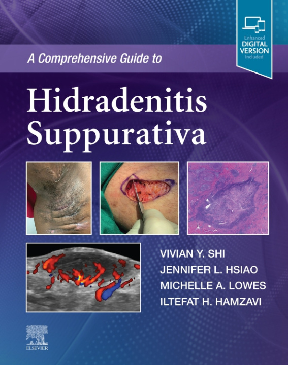 Kniha Comprehensive Guide to Hidradenitis Suppurativa Vivian Y. Shi