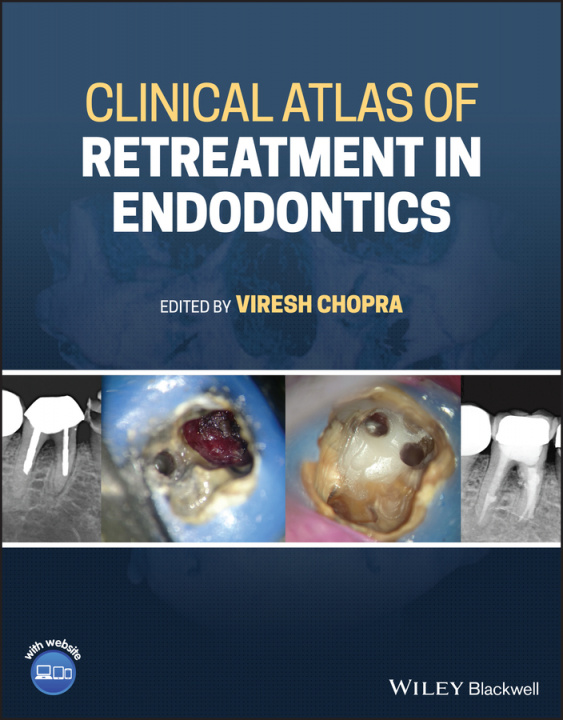 Könyv Clinical Atlas of Retreatment in Endodontics Viresh Chopra