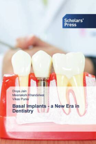Boek Basal Implants - a New Era in Dentistry DIVYA JAIN