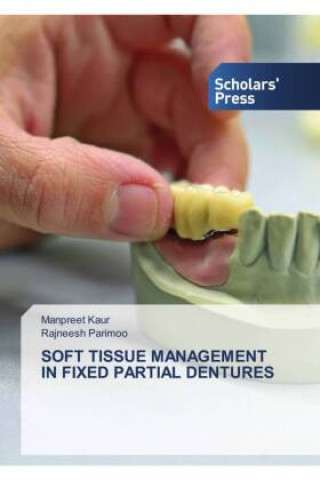 Book Soft Tissue Management in Fixed Partial Dentures MANPREET KAUR