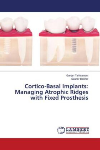 Kniha Cortico-Basal Implants Gunjan Tahilramani