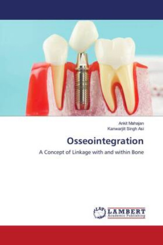 Knjiga Osseointegration ANKIT MAHAJAN