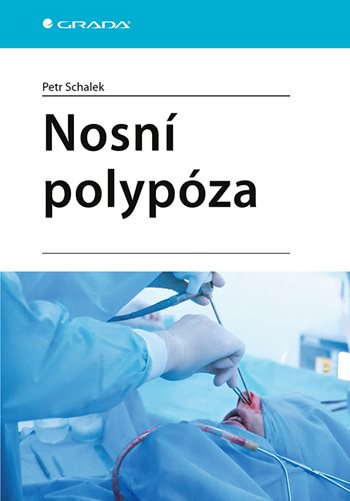 Könyv Nosní polypóza Petr Schalek